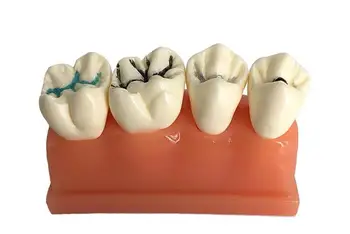 Hambaravi-suuõõne õpetamise mudel hambaarst arsti-patsiendi kommunikatsiooni hamba mudel 3 korda pit ja groove suletud mudel